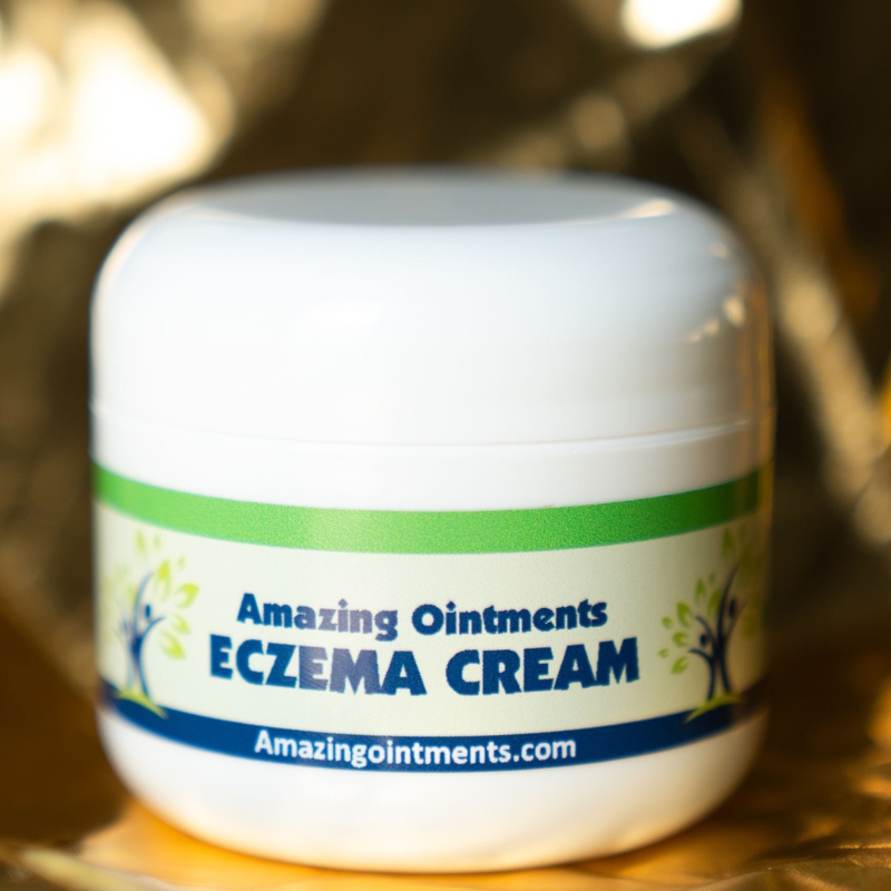 eczema cream